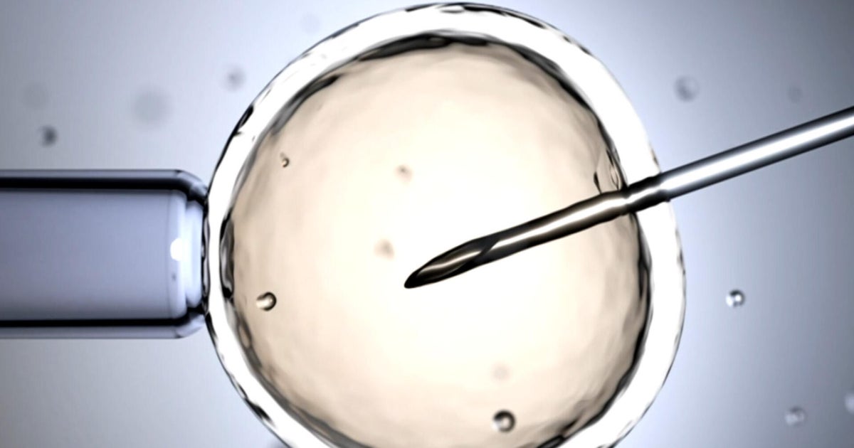 The science and ethics behind genetic embryo screening